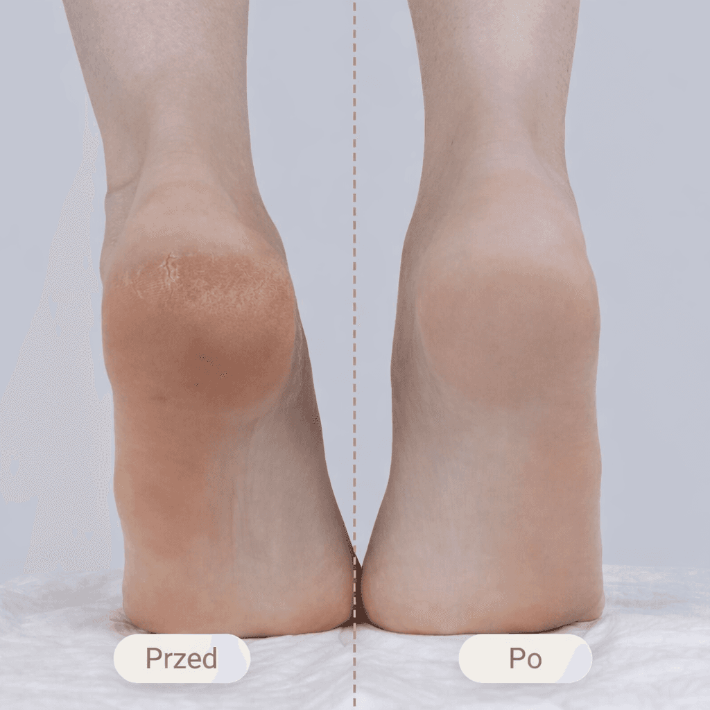 Veluro - SmoothStep Pro